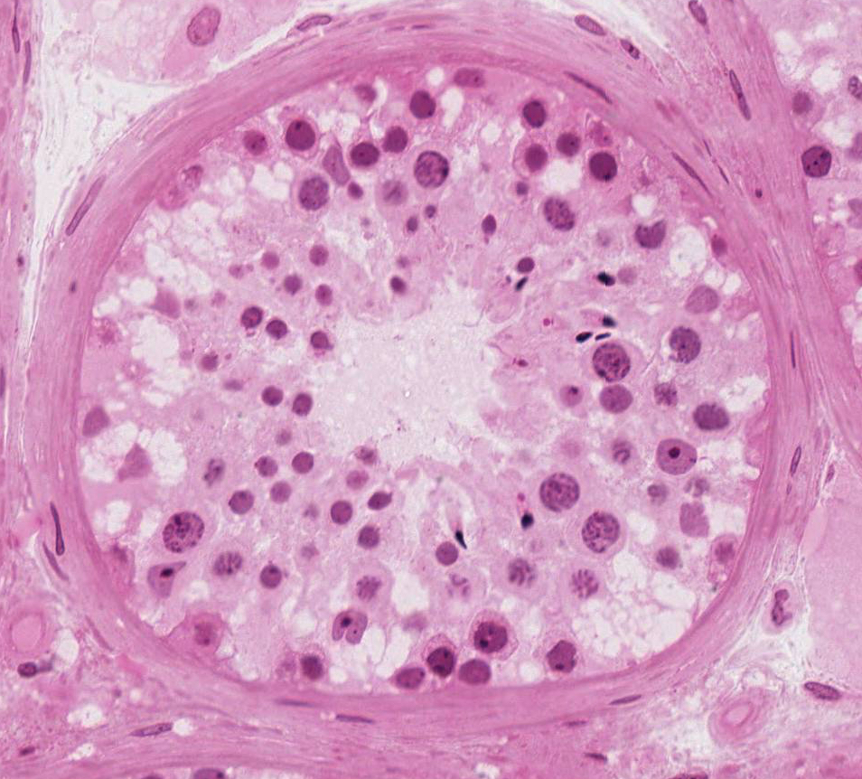 seminiferous tubule histology